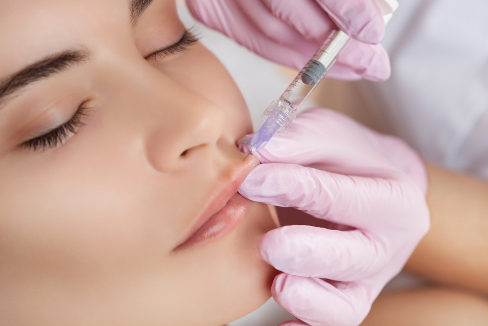 Preenchimento Labial
